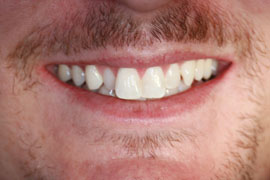 Before Orthodontics